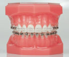 orthodontie2